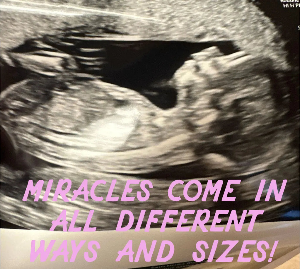 MIRACLES-COME-IN-ALL-DIFFERENT-WAYS-AND-SIZES Late Sunday Afternoon